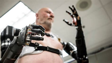 Bionic Human brabet